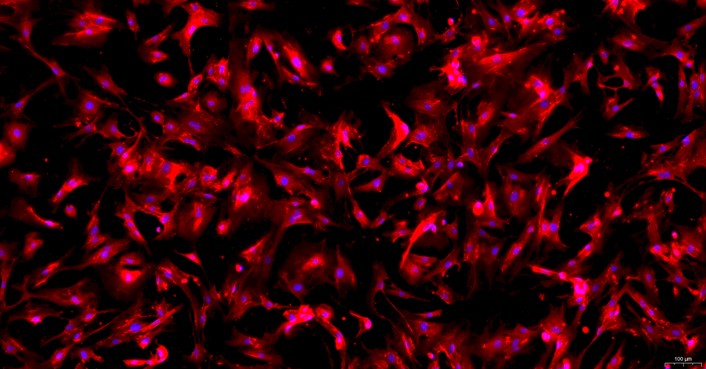 Primary Mouse Mammary Fibroblasts (MF)