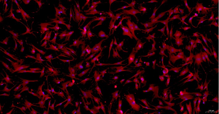 Primary Mouse Mammary Fibroblasts (MF)
