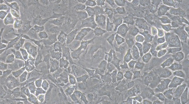 Primary Mouse Osteoblasts (OB)