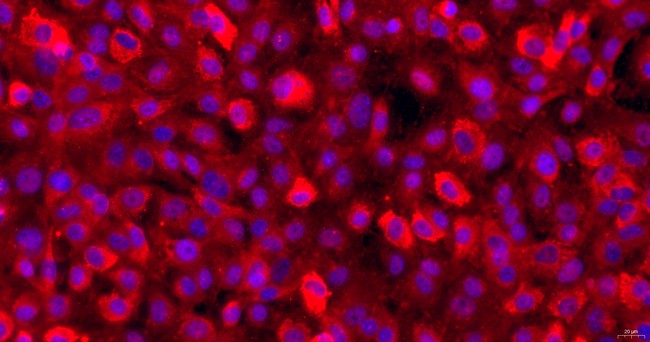 Primary Mouse Osteoblasts (OB)