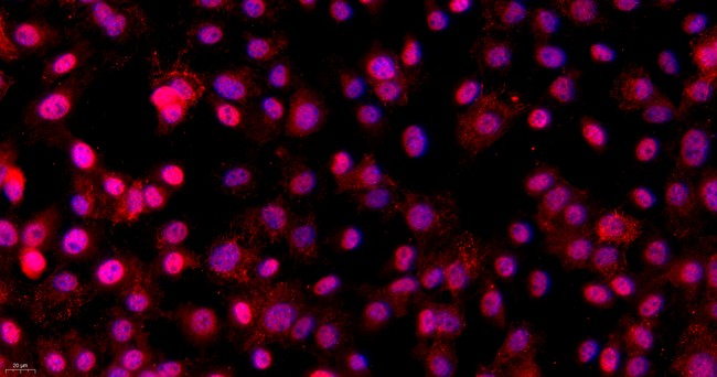 Primary Mouse Osteoblasts (OB)