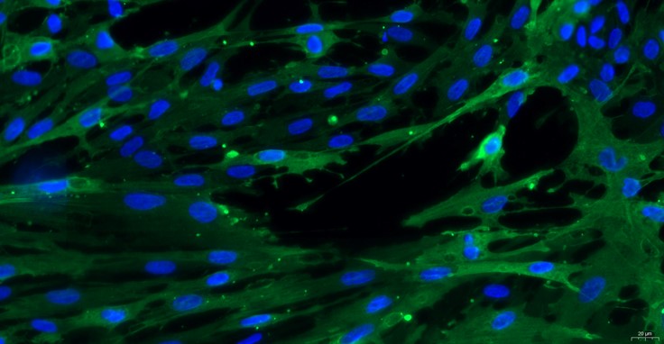 Primary Canine Brain Vascular Pericytes (BVP)