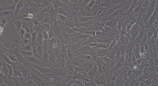 Primary Rabbit Coronary Artery Endothelial Cells (CAEC)