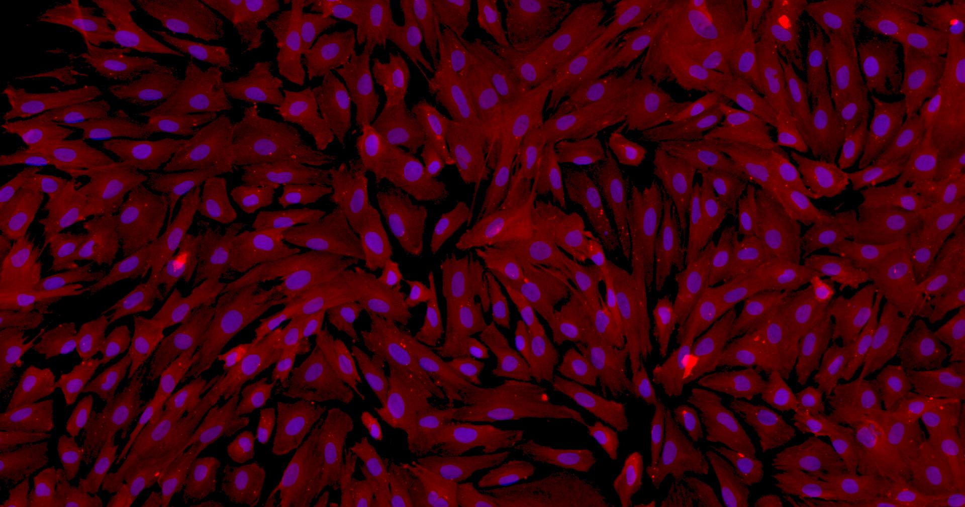 Primary Mouse Umbilical Vein Smooth Muscle Cells (UVSMC)