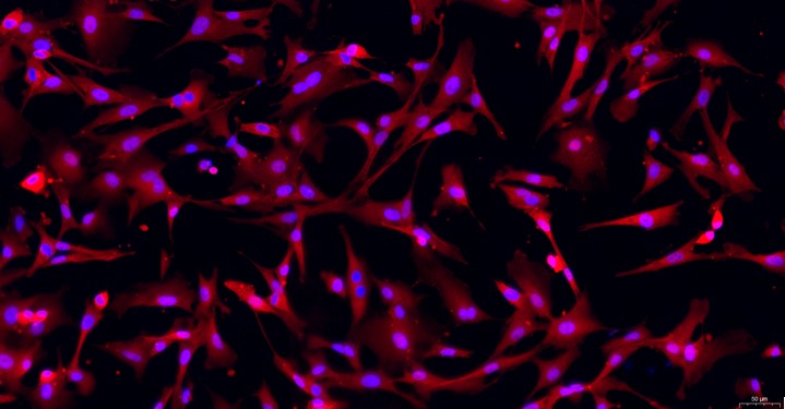 Primary Rabbit Ovarian Fibroblasts (OF)