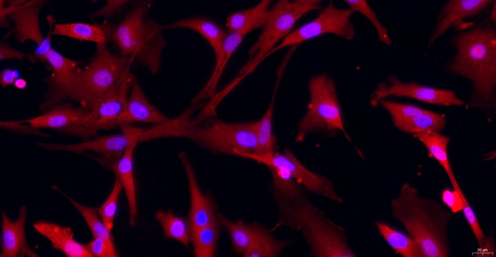Primary Rabbit Ovarian Fibroblasts (OF)