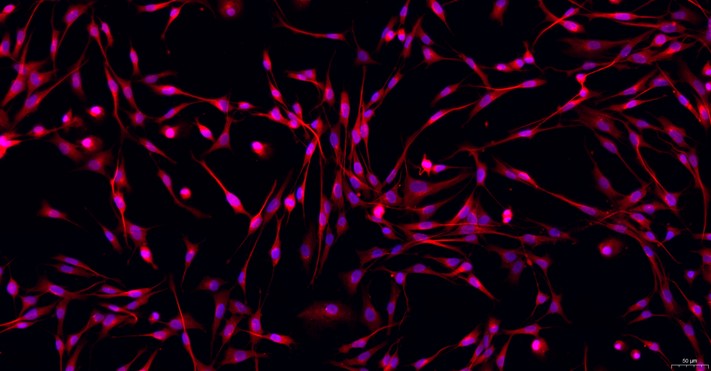Primary Feline Gingival Fibroblasts (GF)