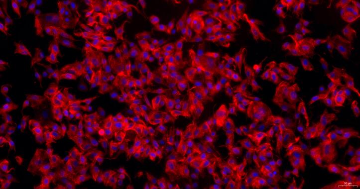 Primary Rabbit Pericardial Fibroblasts (PF)