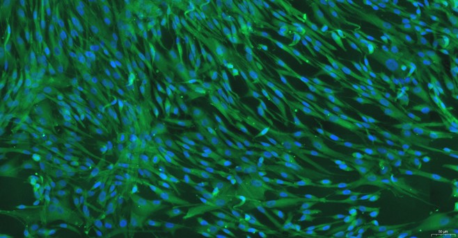 Primary Feline Aortic Smooth Muscle Cells (ASMC)