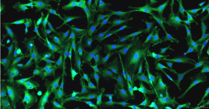 Primary Rat Aortic Smooth Muscle Cells (ASMC)