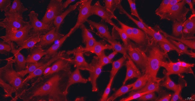 Primary Rat Aortic Smooth Muscle Cells (ASMC)