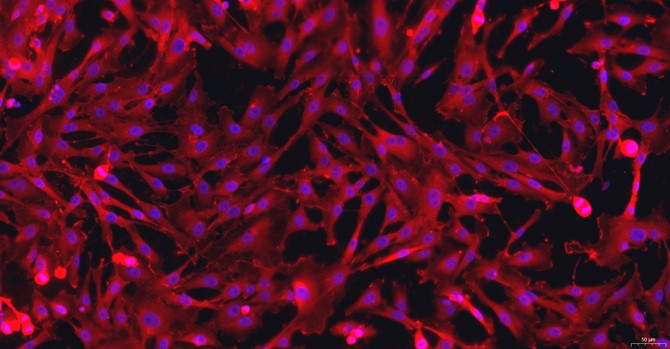 Primary Rat Aortic Smooth Muscle Cells (ASMC)