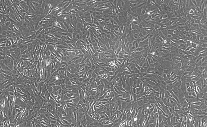 Primary Rat Aortic Smooth Muscle Cells (ASMC)