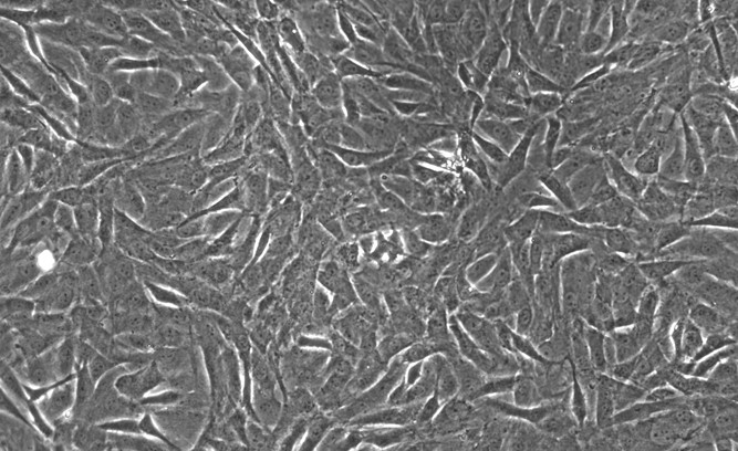 Primary Rat Aortic Smooth Muscle Cells (ASMC)