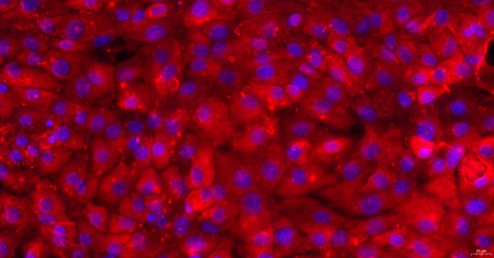 Primary Mouse Seminal Vesicle Epithelial Cells (SVEC)