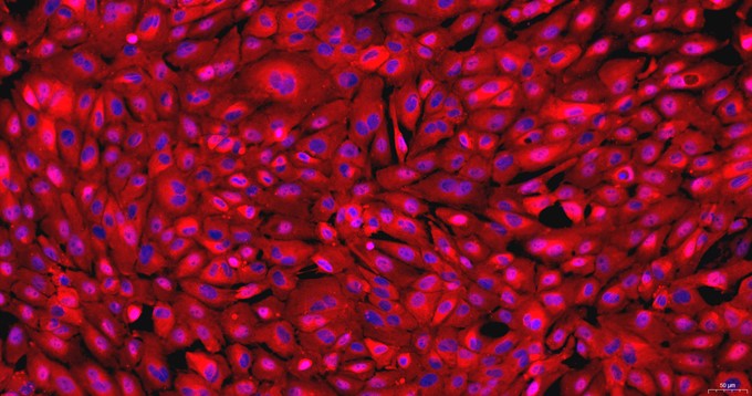Primary Rat Seminal Vesicle Epithelial Cells (SVEC)