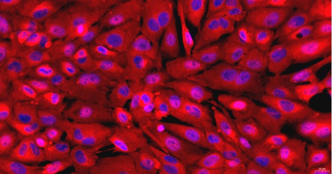 Primary Rat Seminal Vesicle Epithelial Cells (SVEC)