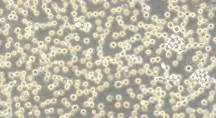Human Burkitt's Lymphoma Cells (BLC)