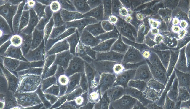 Human Prostate Cancer Cells (PCC)