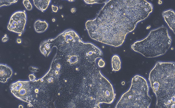 Human Gastric Cancer Cells (GCC)