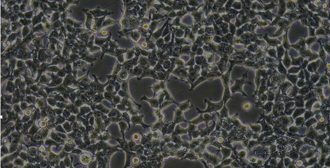 Human Embryonic Kidney Cells (EKC)