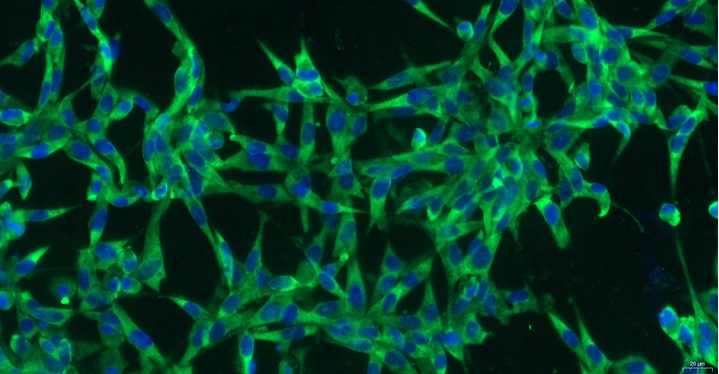 Primary Canine Trigeminal Ganglion Neuron Cells (TGN)