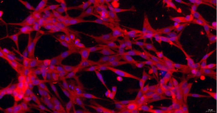 Primary Canine Trigeminal Ganglion Neuron Cells (TGN)