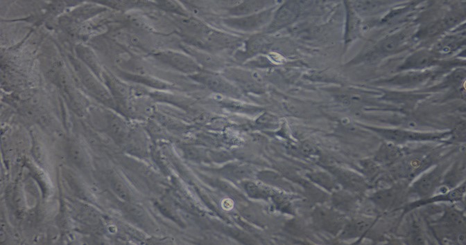 Primary Rat Skeletal Muscle Fibroblasts (SMF)