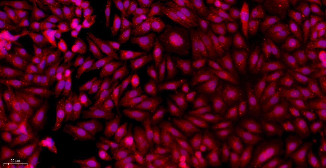 Primary Mouse Placental Mesenchymal Stem Cells (PMSC)