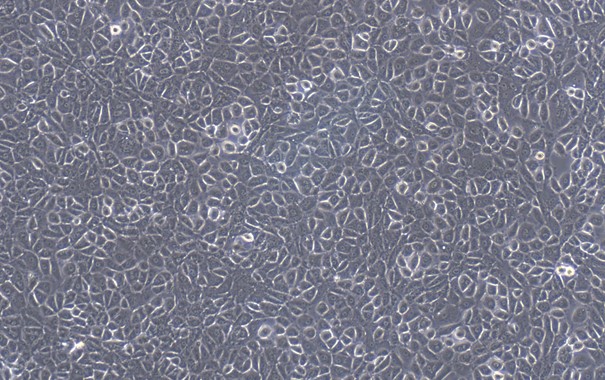 Primary Mouse Peritoneal Mesothelial Cells (PMC)