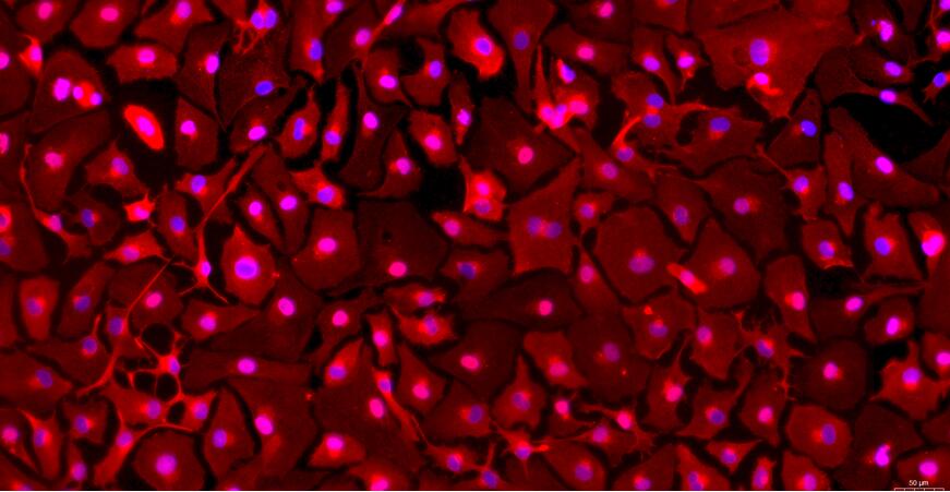 Primary Rabbit Peritoneal Mesothelial Cells (PMC)