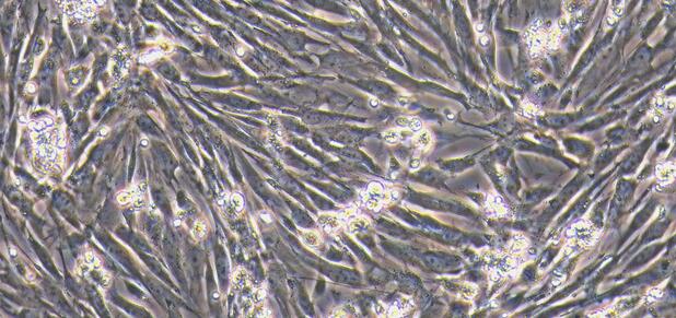 Primary Canine Ureteral Smooth Muscle Cells (USMC)