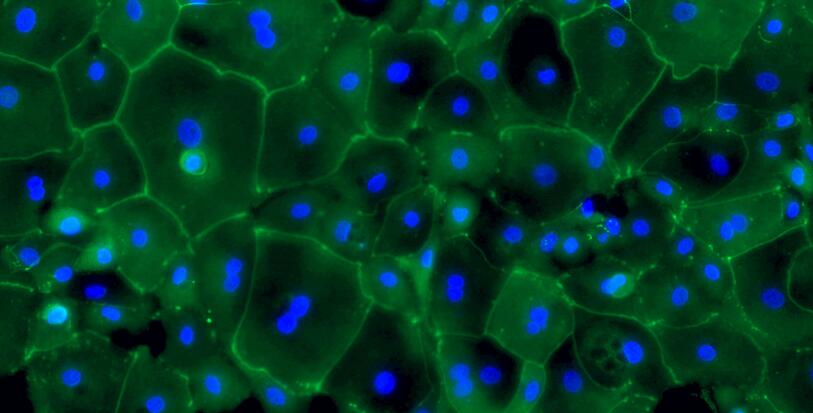 Primary Canine Ureteral Epithelial Cells (UEC)