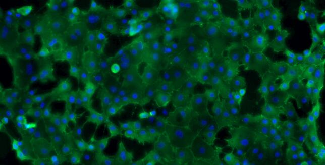 Primary Caprine Ureteral Epithelial Cells (UEC)