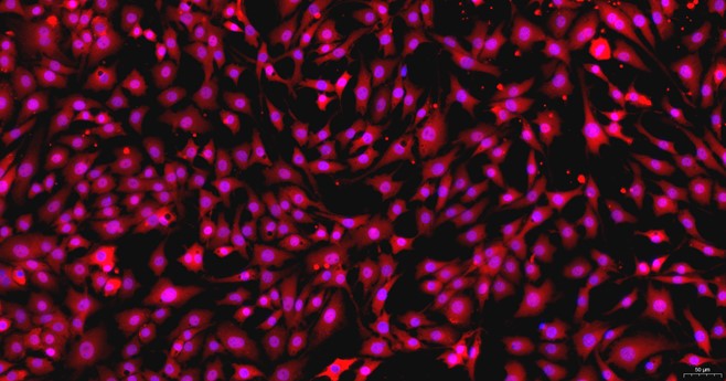 Primary Mouse Auricular Chondrocytes (ACC)