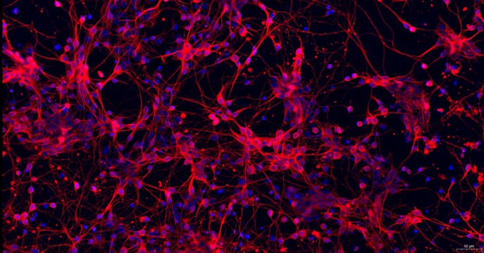 Primary Mouse Cerebral Cortex Neuron Cells (CCNC)
