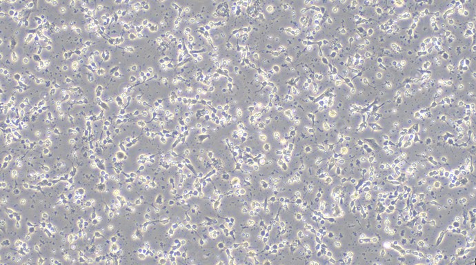 Primary Mouse Cerebral Cortex Neuron Cells (CCNC)