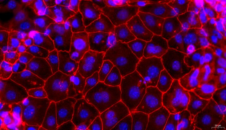 Primary Rabbit Vas Deferens Epithelial Cells (VDEC)