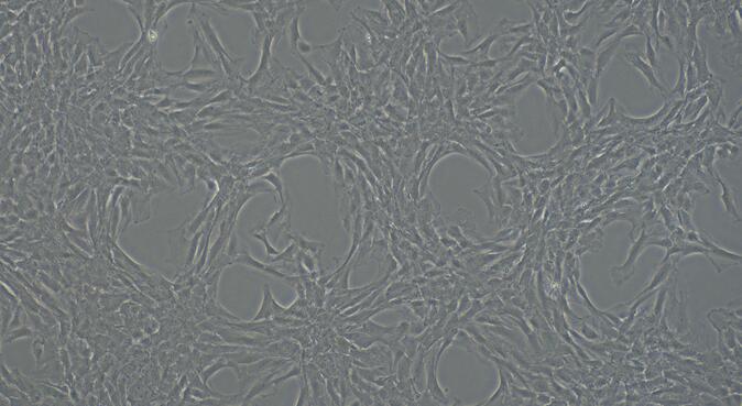 Primary Rat Femoral Artery Endothelial Cells (FAEC)