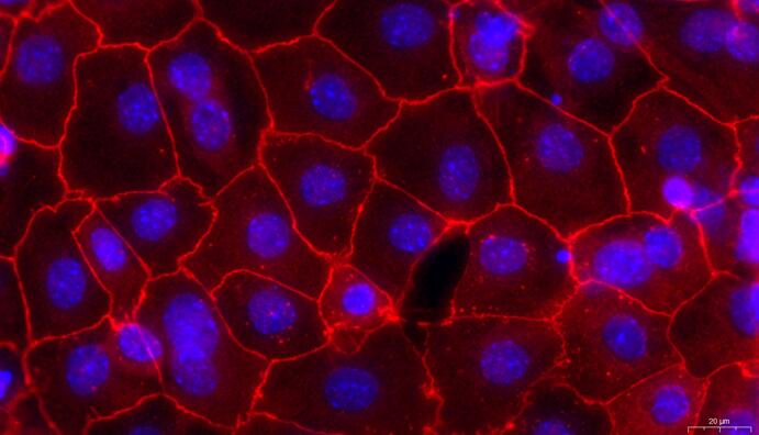 Primary Mouse Fallopian Tube Epithelial Cells (FTEC)