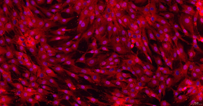 Primary Rat Tracheal Chondrocytes (TrC)