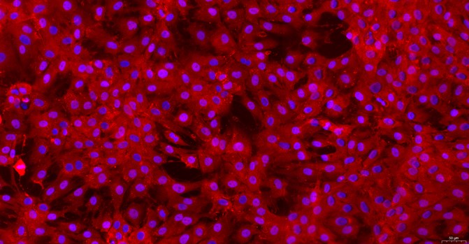Primary Rat Tracheal Chondrocytes (TrC)