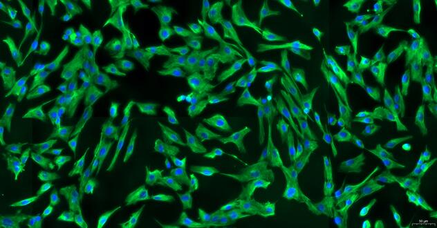 Primary Canine Cardiac Valve Interstitial Cells (CVIC)