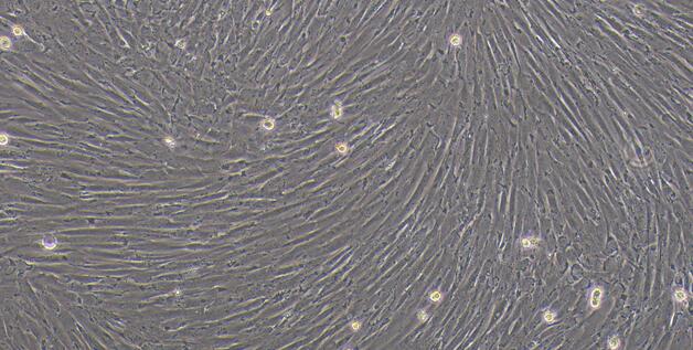 Primary Canine Cardiac Valve Interstitial Cells (CVIC)