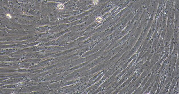 Primary Canine Cardiac Valve Interstitial Cells (CVIC)