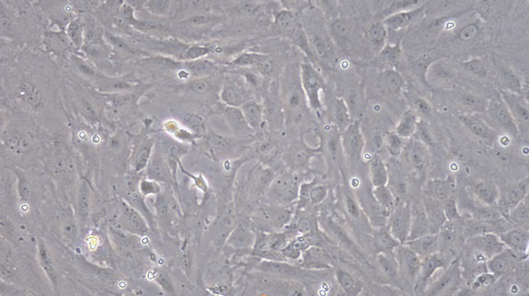 Primary Rat Cardiac Valve Interstitial Cells (CVIC)