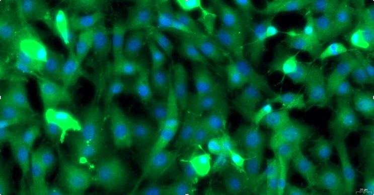 Primary Rat Cardiac Valve Interstitial Cells (CVIC)