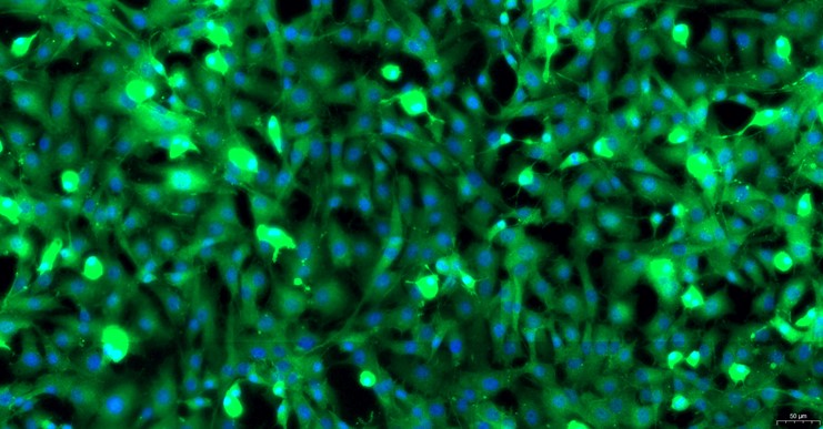 Primary Rat Cardiac Valve Interstitial Cells (CVIC)