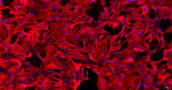 Primary Rabbit Cardiac Valve Interstitial Cells (CVIC)
