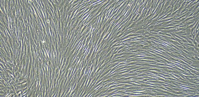 Primary Canine Endocardial Fibroblasts (EnCF)